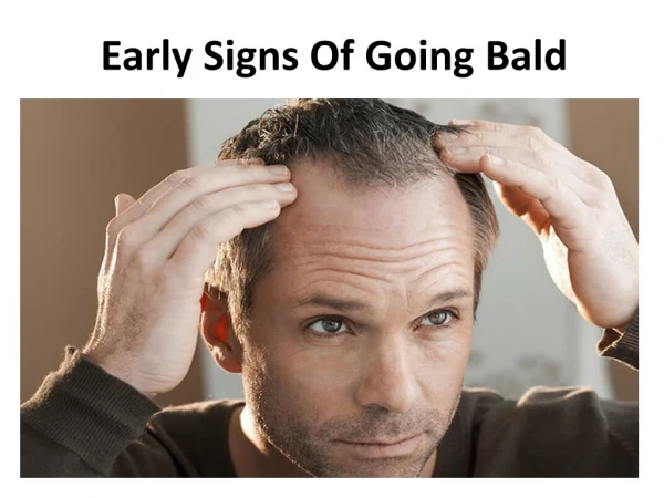 Early Signs Of Going Bald