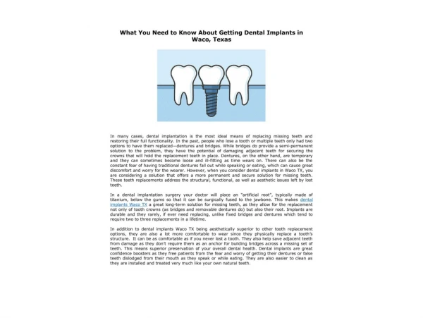 What You Need to Know About Getting Dental Implants in Waco, Texas