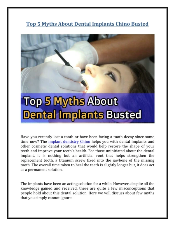 Top 5 Myths About Dental Implants Chino Busted