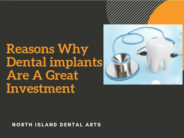 Dental implants help you look fabulous | North Island Dental Arts