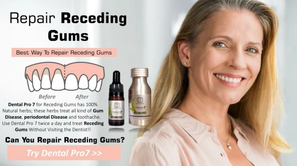 Natural Remedies To Repair Receding Gums
