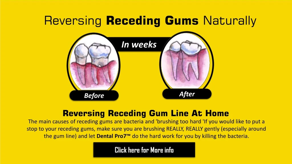 reversing receding gums naturally