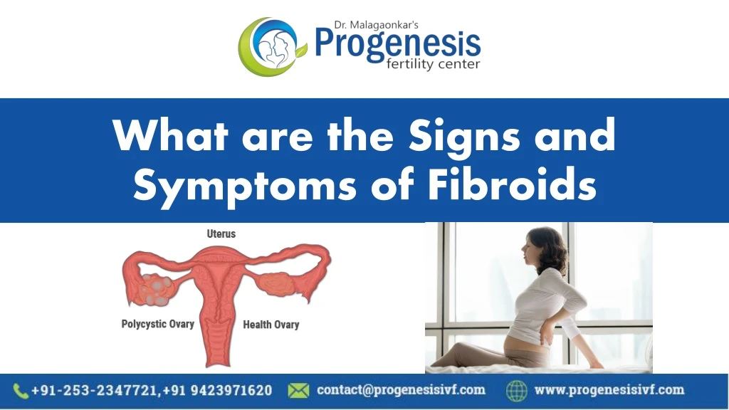 what are the signs and symptoms of fibroids