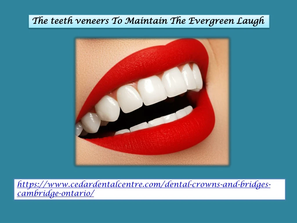 the teeth veneers to maintain the evergreen laugh