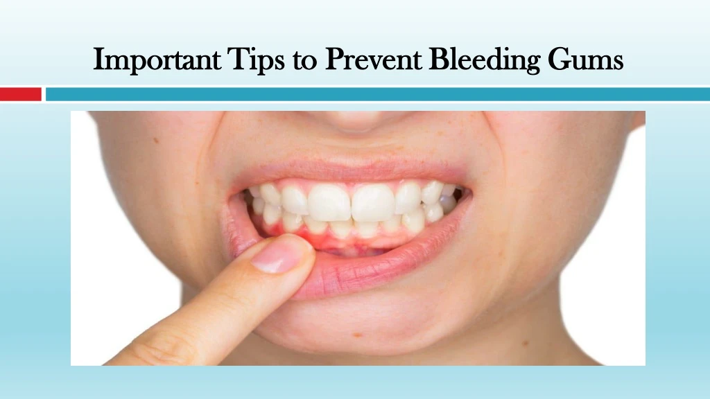 important tips to prevent bleeding gums