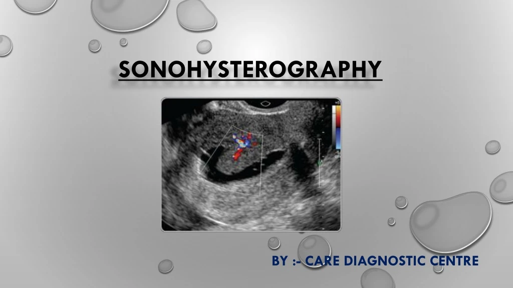 sonohysterography