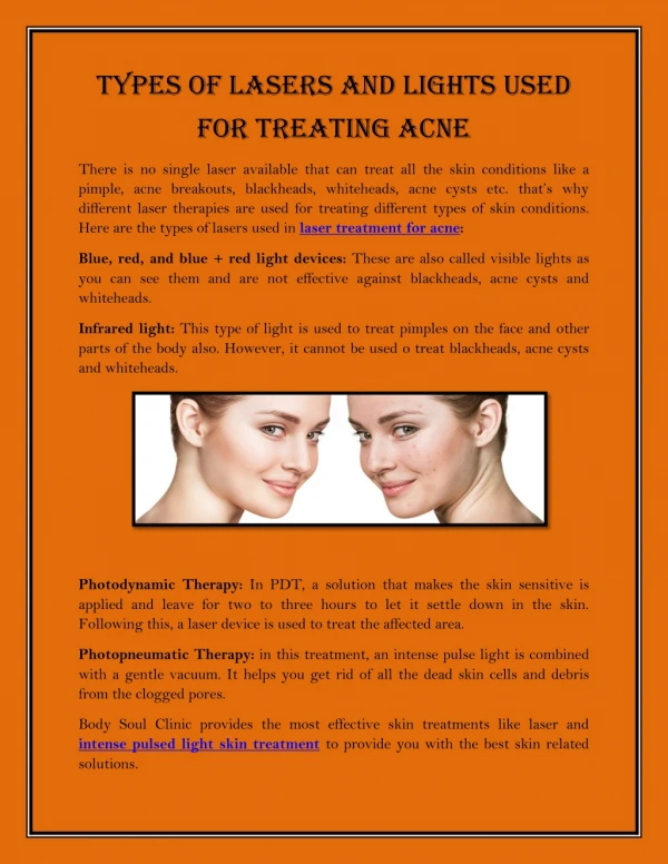 Types Of Lasers And Lights Used For Treating Acne