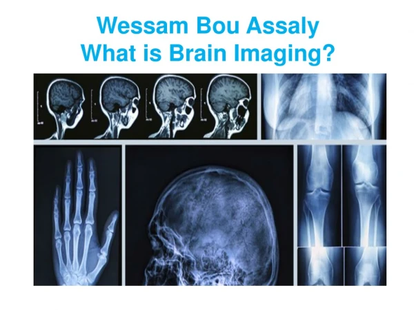 Wessam Bou-Assaly ~ Equipment And Radiological Methods For Brain Imaging