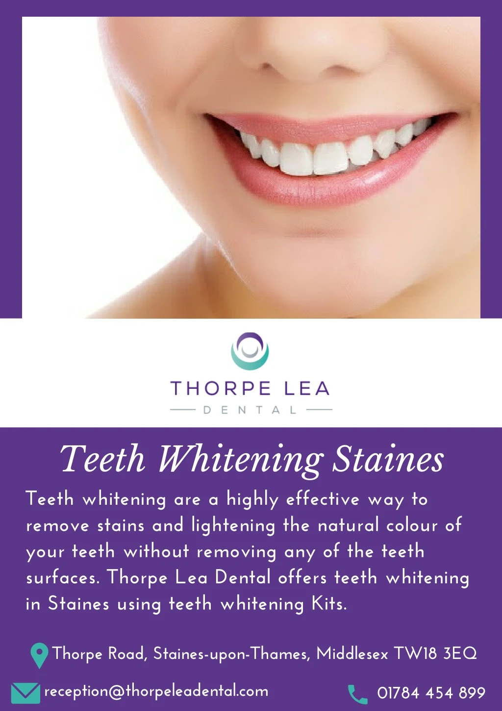 teeth whitening staines teeth whitening