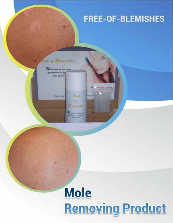 Buy Moles Removal Products Online – Order Now