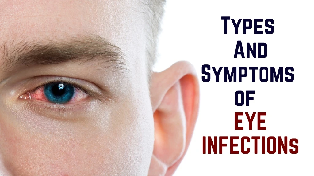 types and symptoms of eye infections