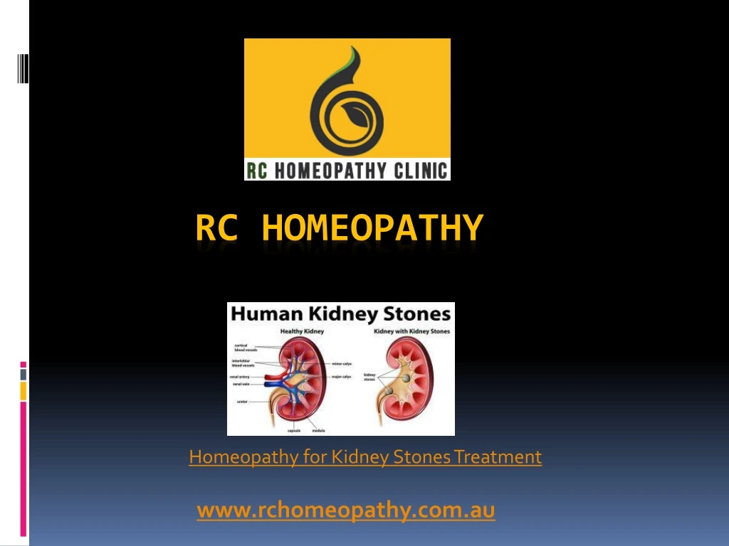 homeopathy for kidney stones treatment