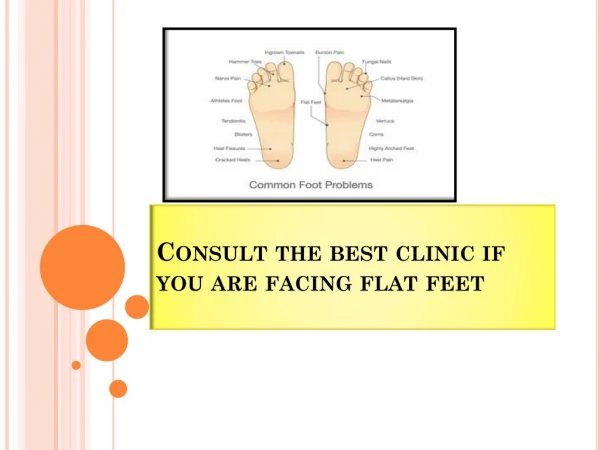 Consult the best clinic if you are facing flat feet