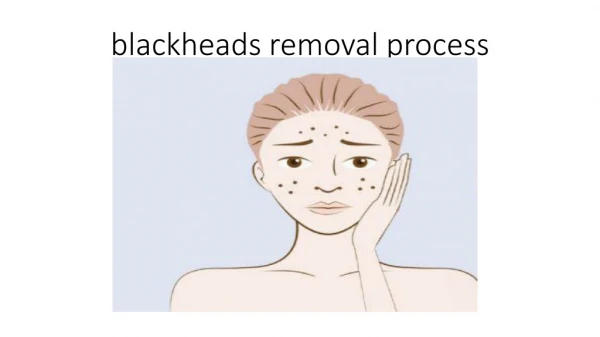 best blackheads removal process