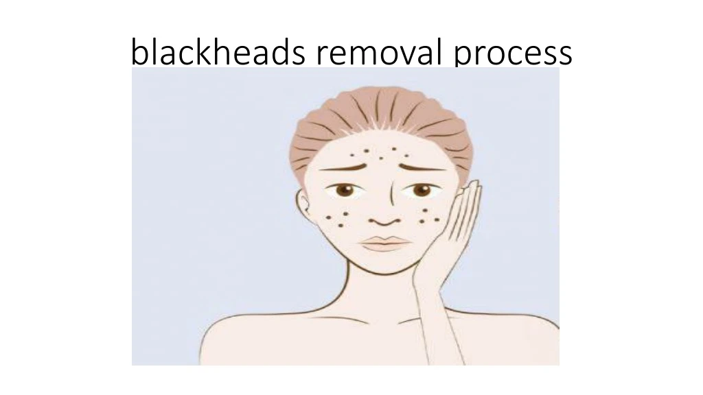 blackheads removal process