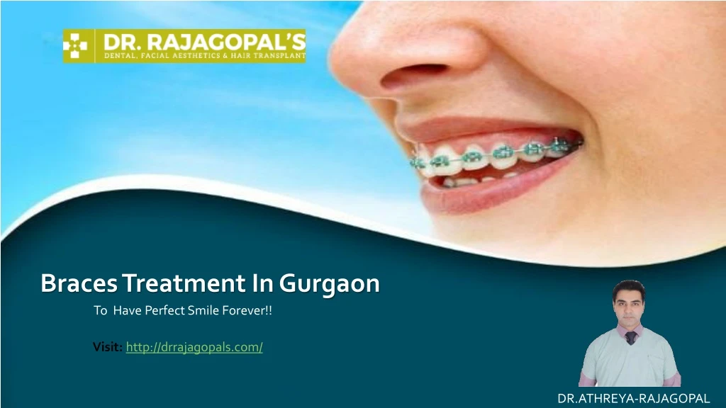 braces treatment in gurgaon