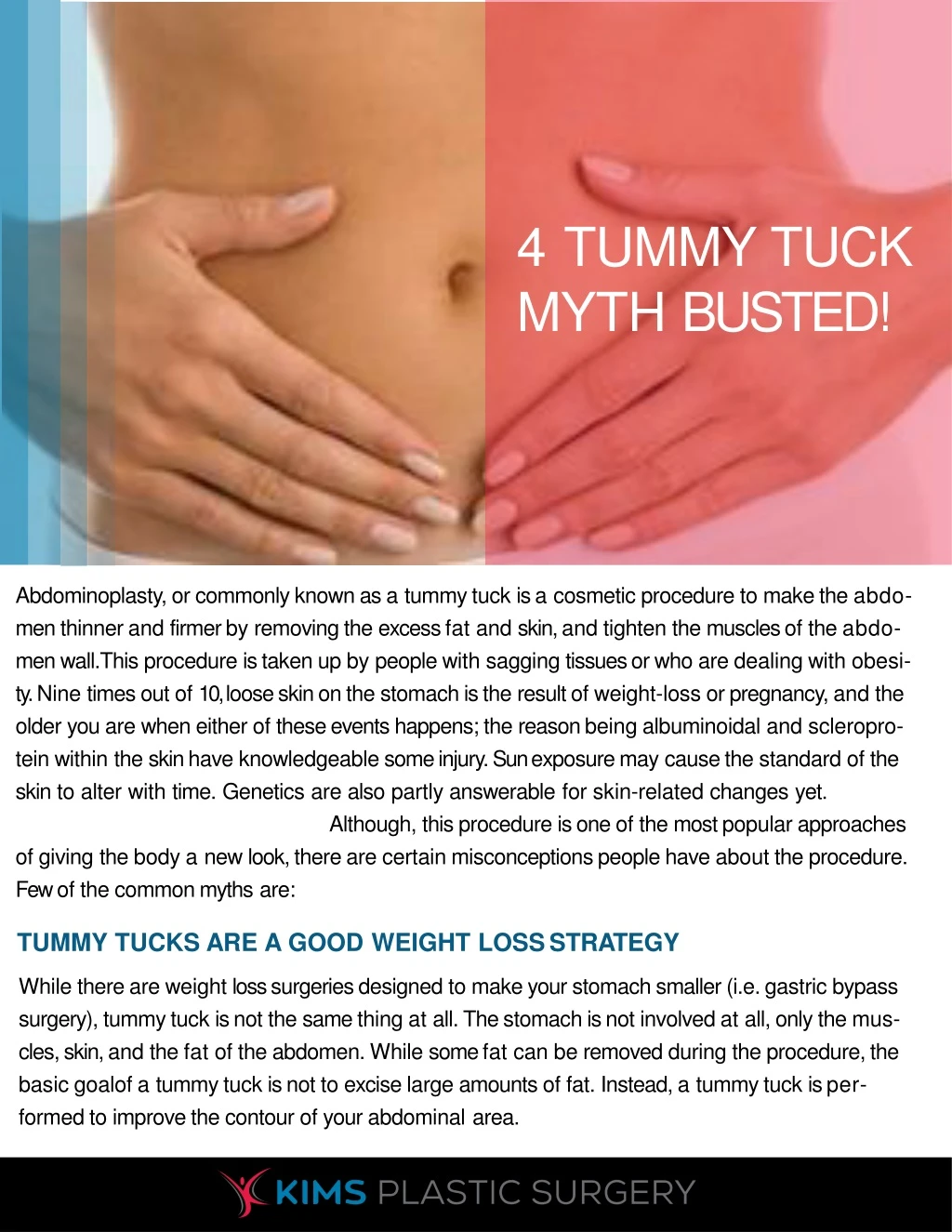 4 tummy tuck myth busted