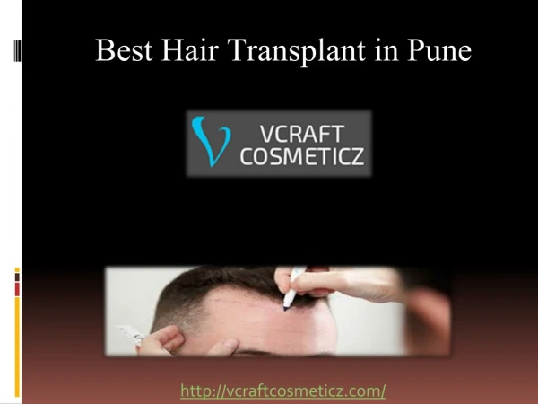 FUE Hair Transplant in Pune