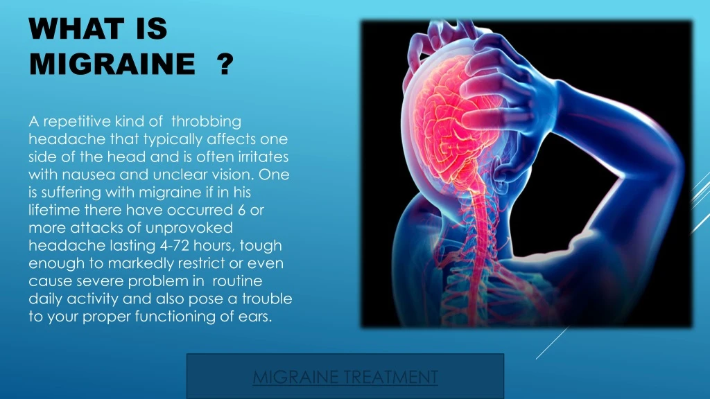what is migraine