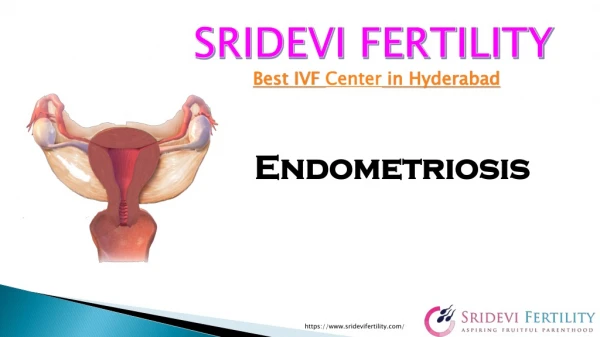 Endometriosis Specialist in Hyderabad | Best IUI Center in Hyderabad