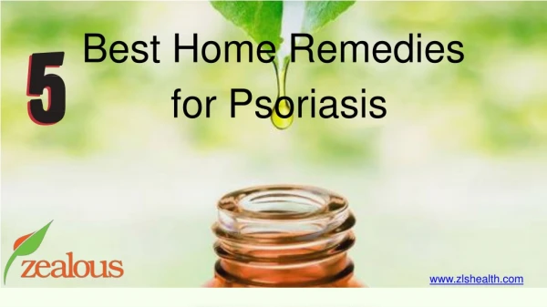 5 Best Home Remedies For Psoriasis