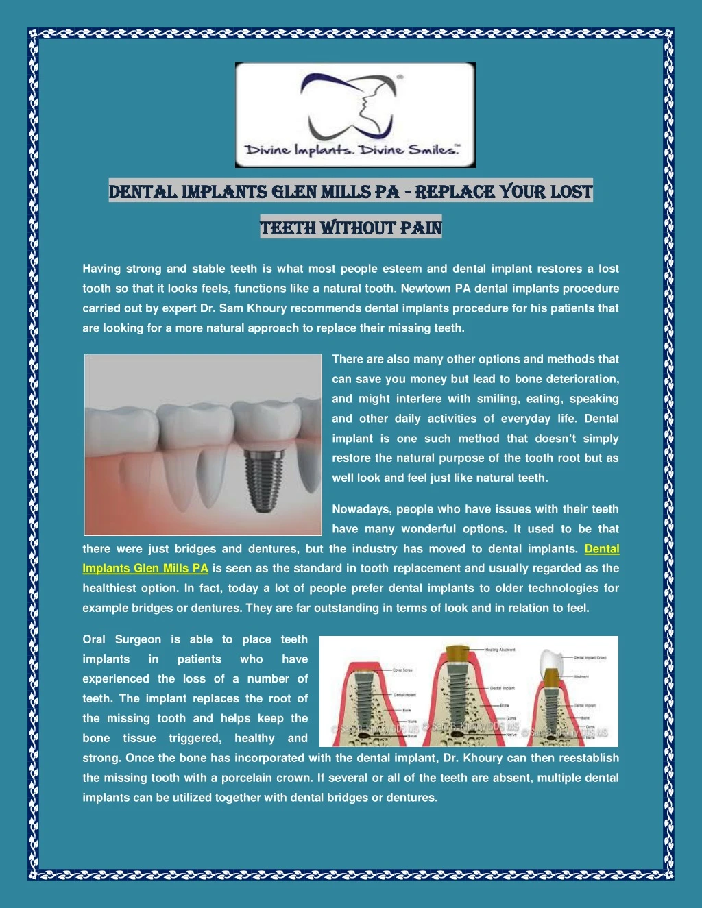 dental implants glen mills pa dental implants