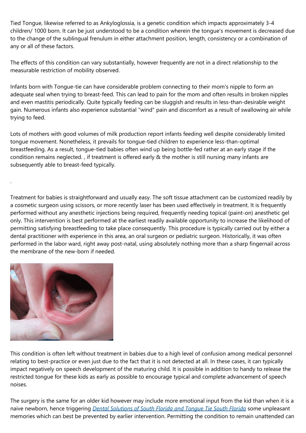 tied tongue likewise referred to as ankyloglossia