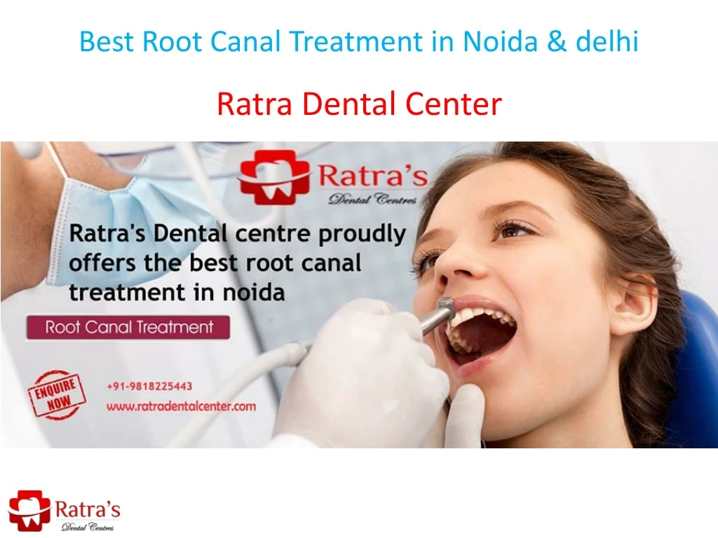 best root canal treatment in noida delhi