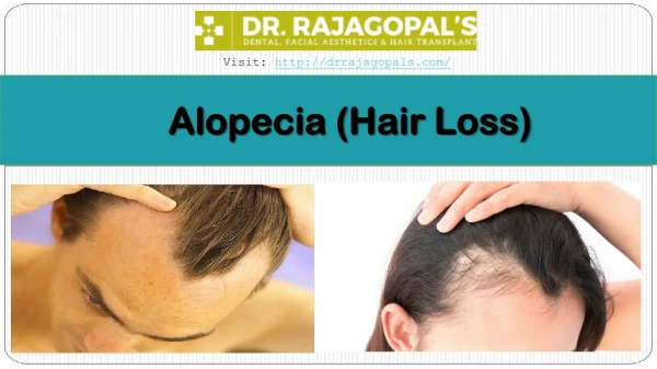 Hair Transplant in Gurgaon- Alopecia Treatment