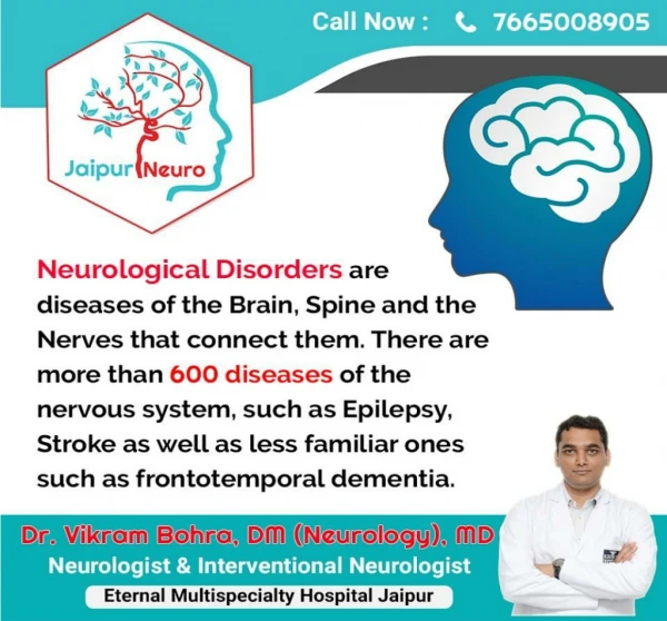 Do you have second opinion for stroke treatment in Jaipur.