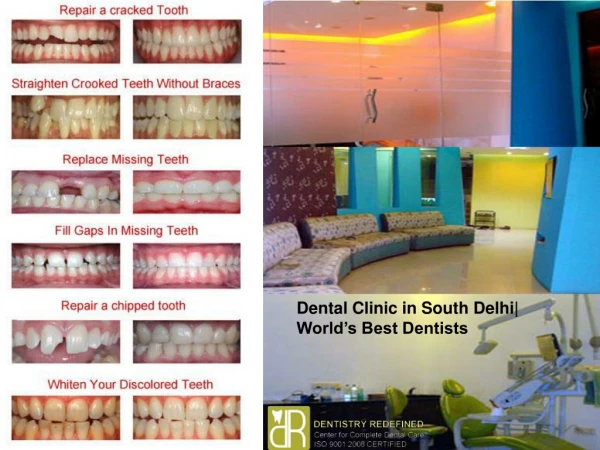 Dental Clinic in South Delhi- World’s Best Dentists Available
