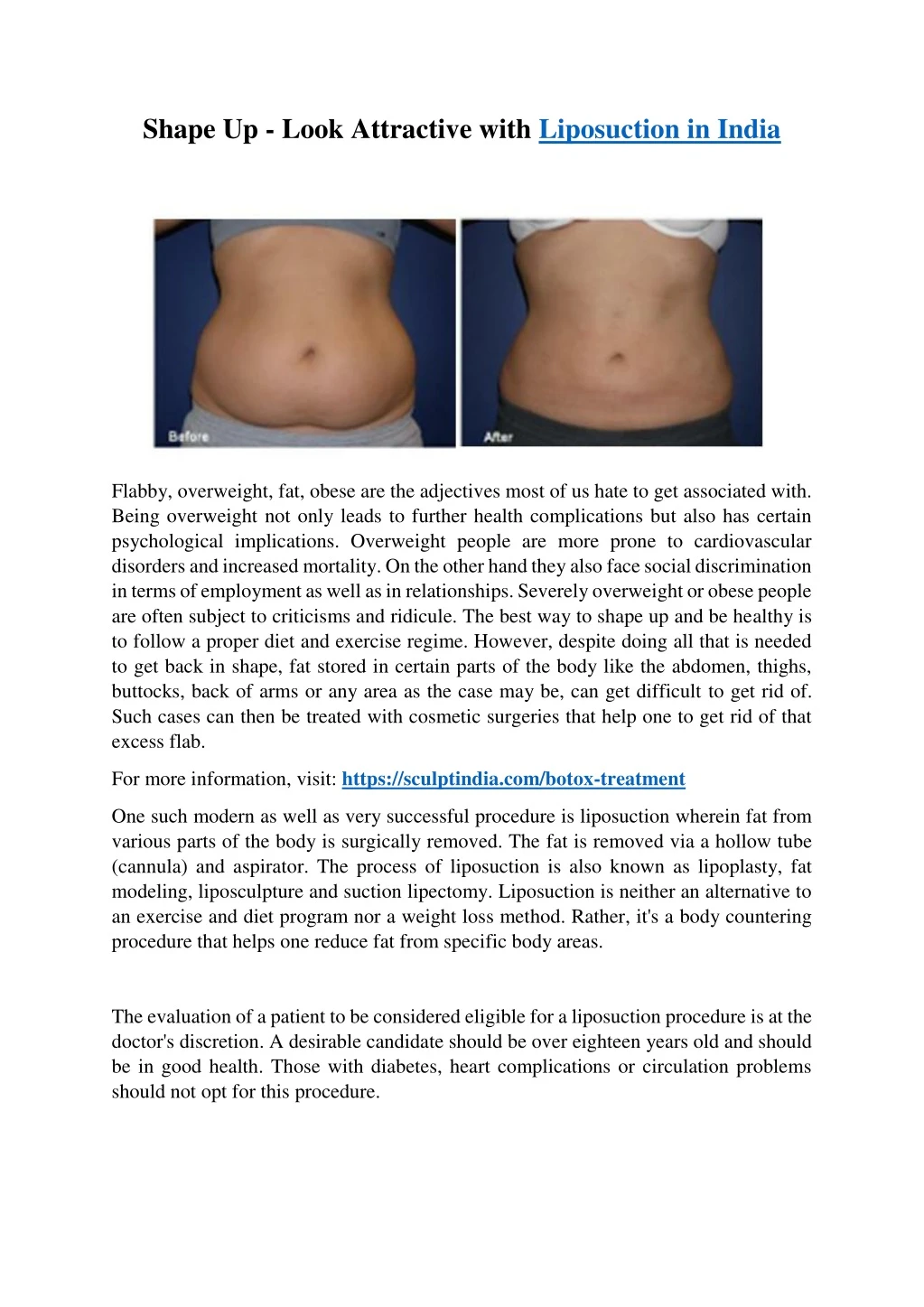 shape up look attractive with liposuction in india