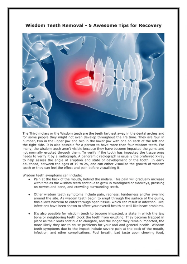 Wisdom teeth removal - 5 awesome tips for recovery