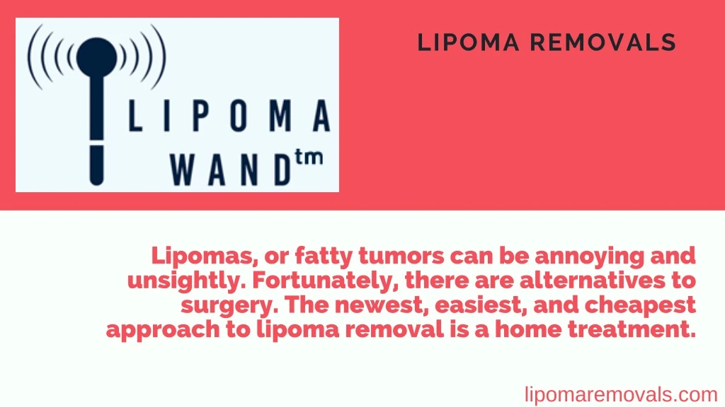 lipoma removals