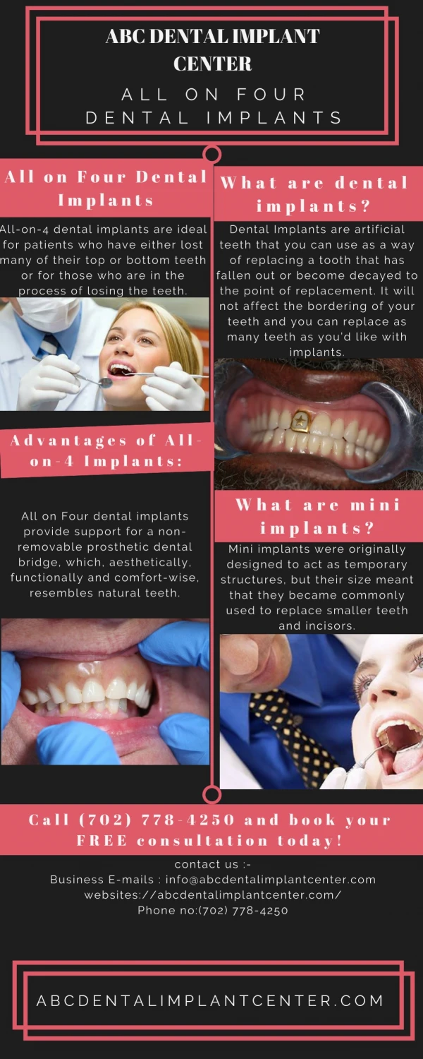 Advantages of All-on-4 Implants