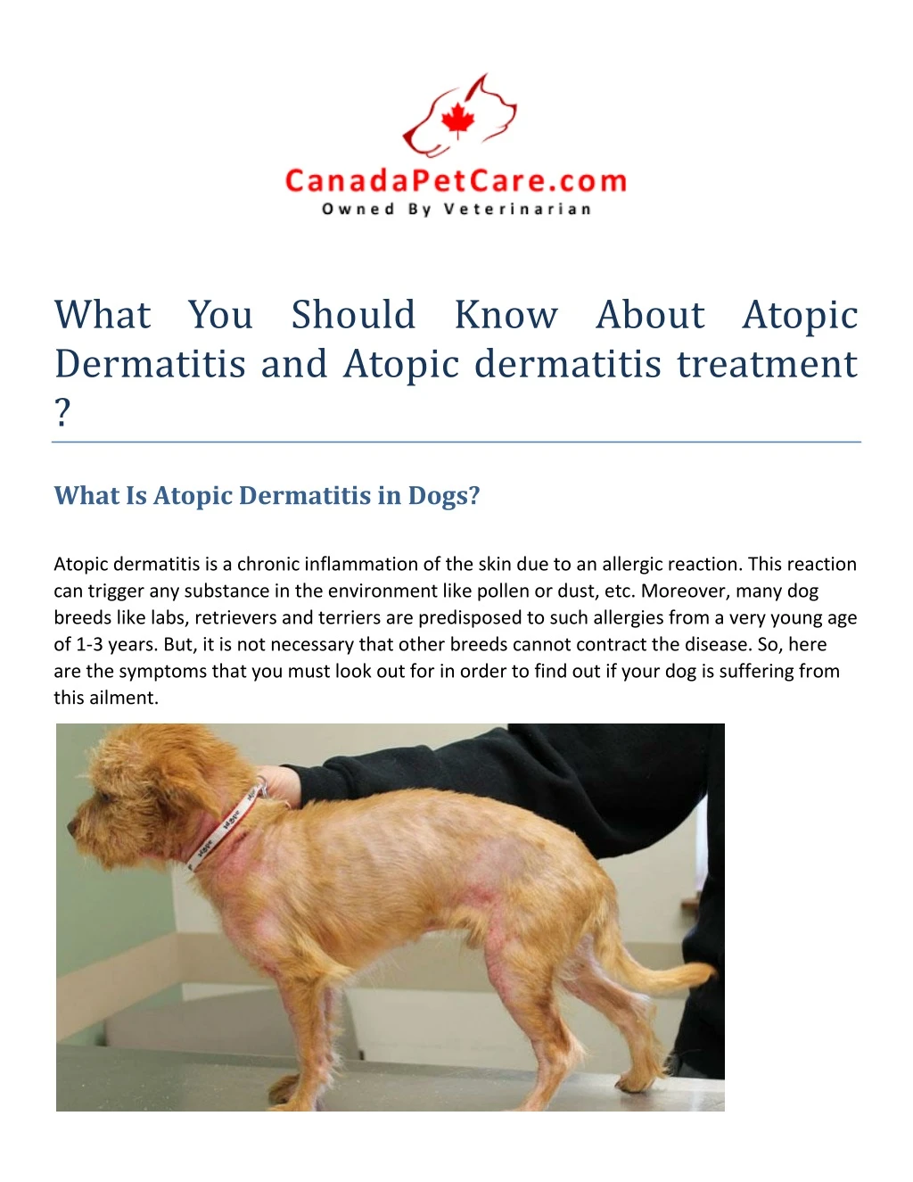 what you should know about atopic dermatitis