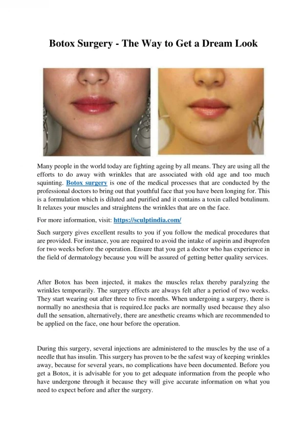 Botox Surgery - The Way To Get a Dream Look