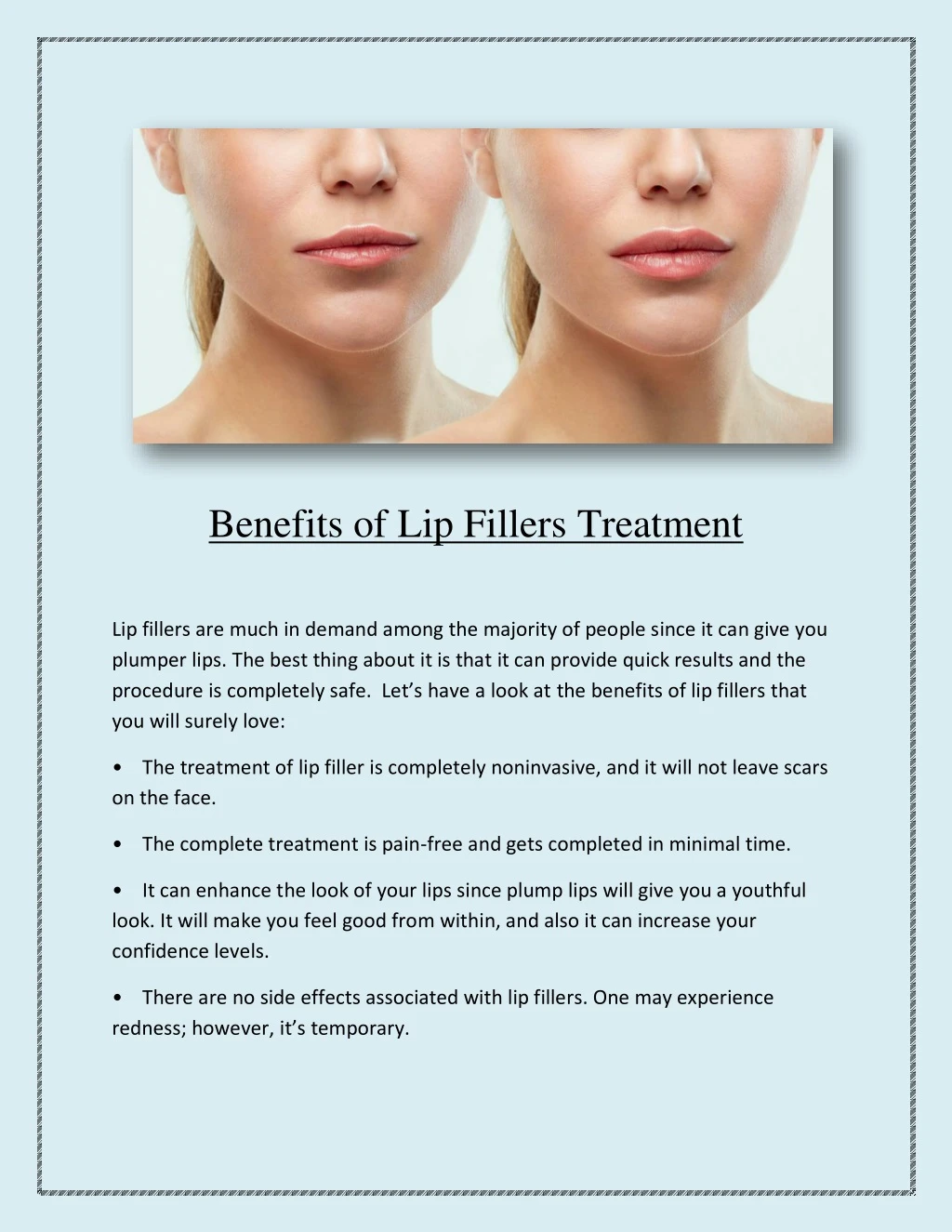 benefits of lip fillers treatment