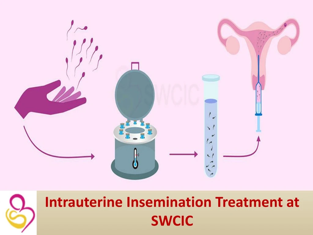 intrauterine insemination treatment at swcic