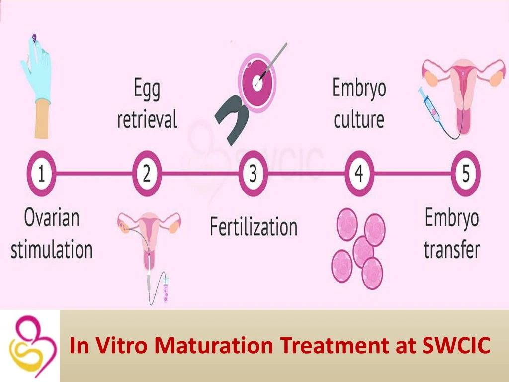 in vitro maturation treatment at swcic