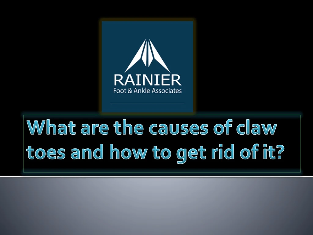 what are the causes of claw toes and how to get rid of it