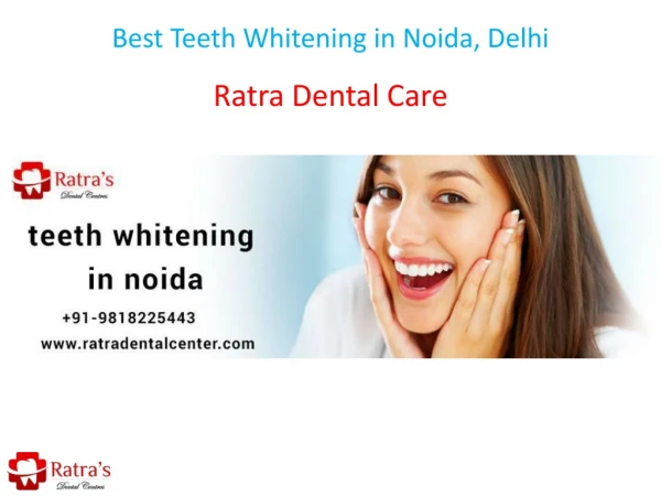 Best Teeth Whitening in Noida, Delhi