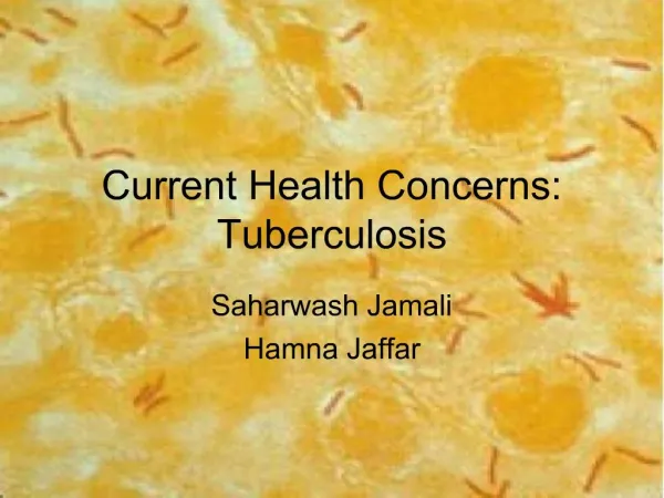 Current Health Concerns: Tuberculosis