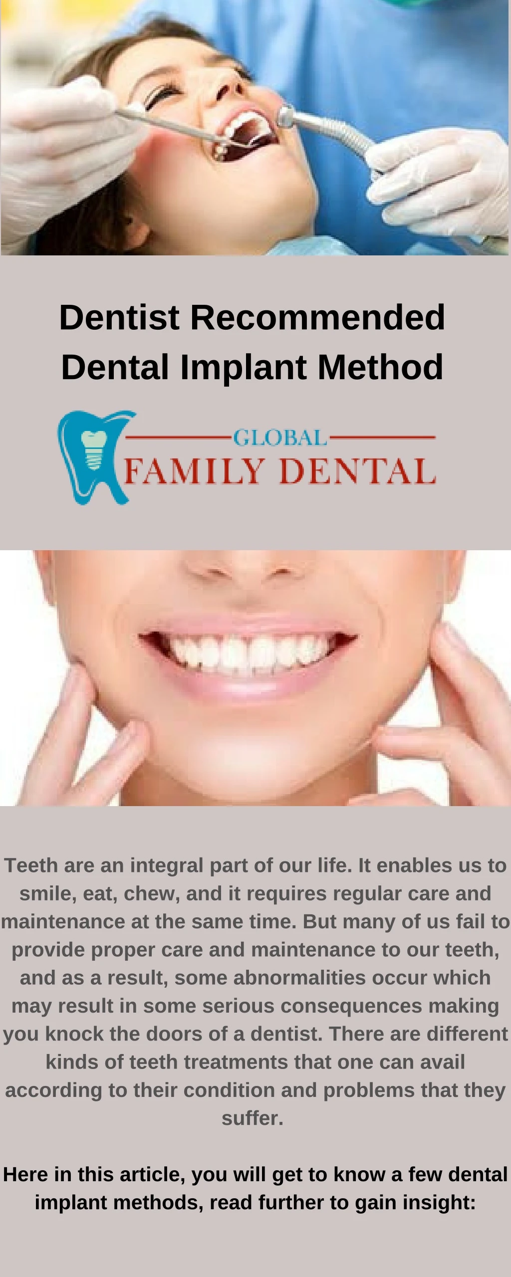 dentist recommended dental implant method