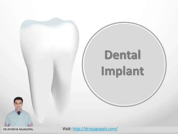 Dental Implants in Gurgaon- Dr. RajaGopal's Clinic.