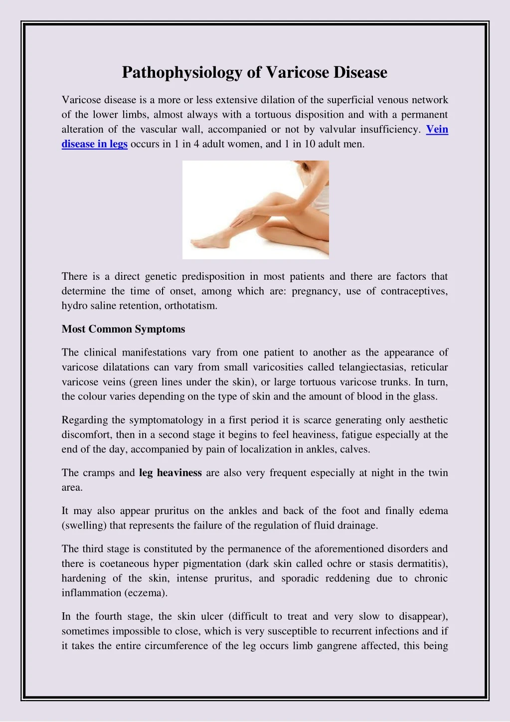 pathophysiology of varicose disease