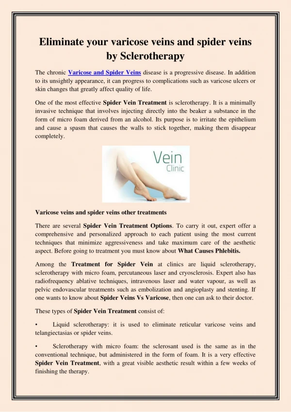 Eliminate your varicose veins and spider veins by Sclerotherapy