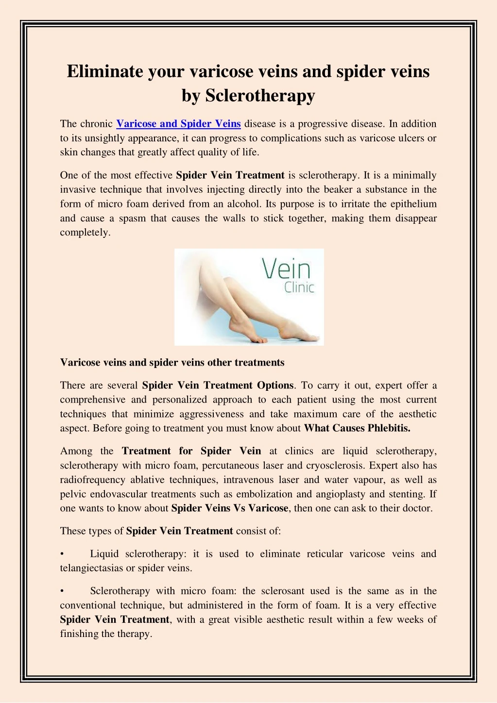eliminate your varicose veins and spider veins