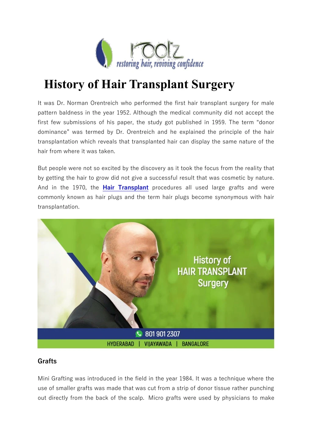 history of hair transplant surgery