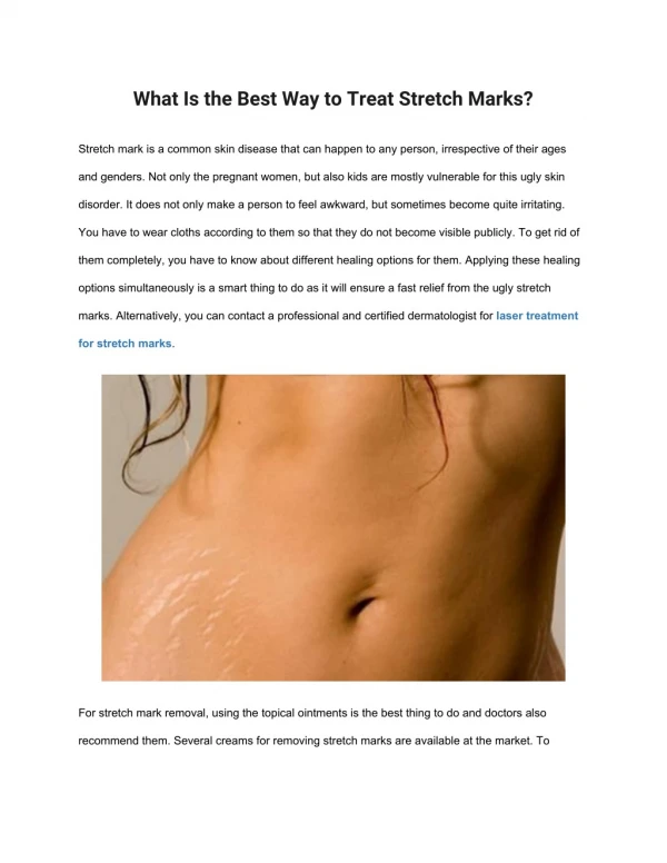 What Is the Best Way to Treat Stretch Marks?